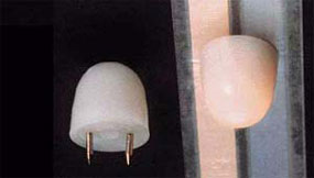 Cir-Kit SMALL PIN-IN CEILING GLOBE - 206-842